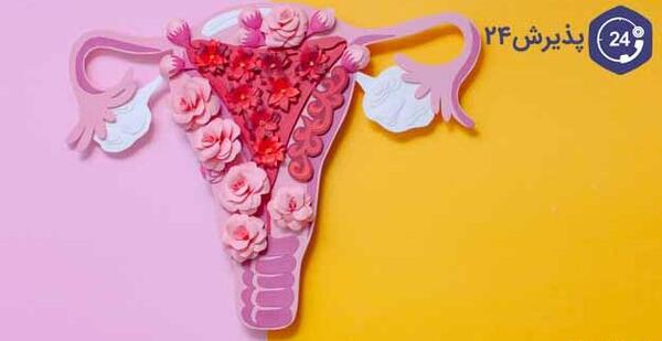 عکس کیست دفع شده در پریودی