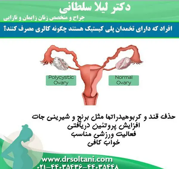 عکس کیست دفع شده در پریودی