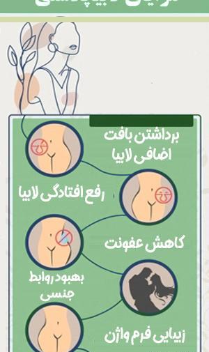 لابيا ماژور عکس های واقعی عمل لابیاپلاستی