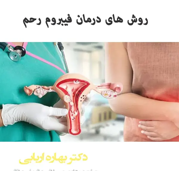 عکس فیبروم دفع شده در پریودی