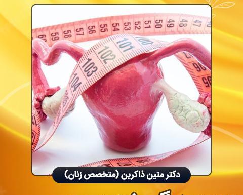 عکس فیبروم دفع شده در پریودی