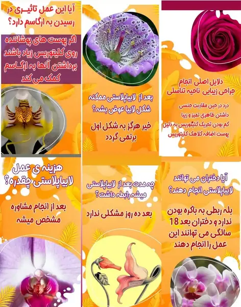 لابياپلاستي عکس های واقعی عمل لابیاپلاستی
