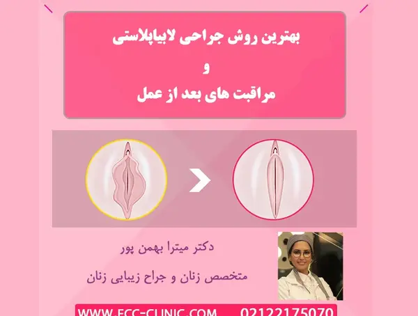 لابياپلاستي عکس های واقعی عمل لابیاپلاستی