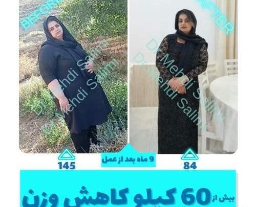 عکس ادم های چاقی که لاغر شدند