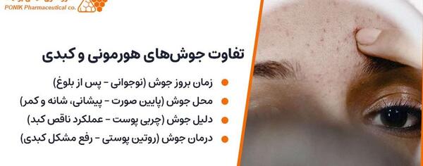 عکس جوش های کبد چرب