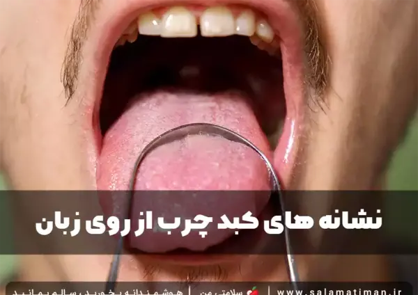 عکس جوش های کبد چرب