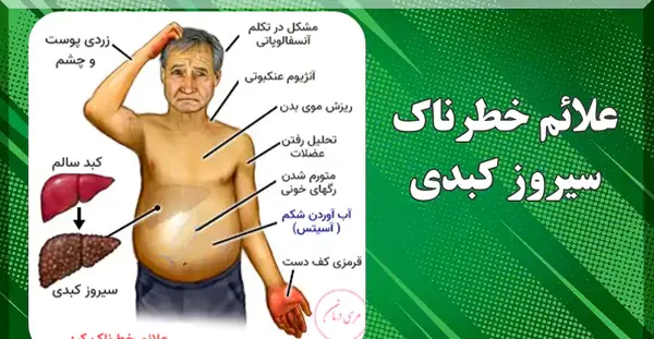 عکس جوش های کبد چرب