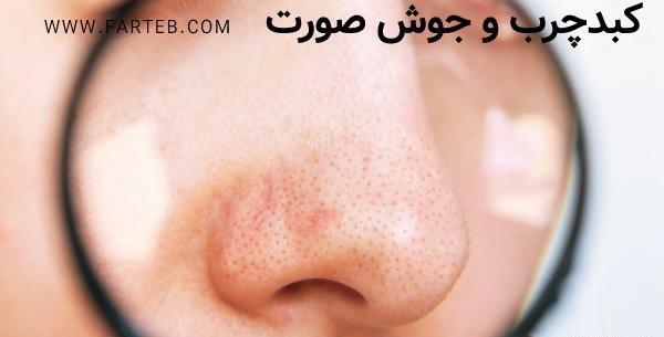 عکس جوش های کبد چرب