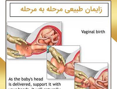 عکس زایمان طبیعی از نزدیک
