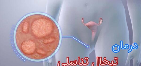 عکس تبخال تناسلی مردان