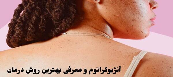 عکس آلت مردانه