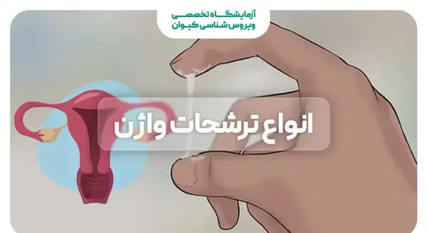 عکس ترشحات در بارداری