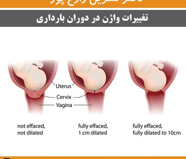 عکس ترشحات در بارداری