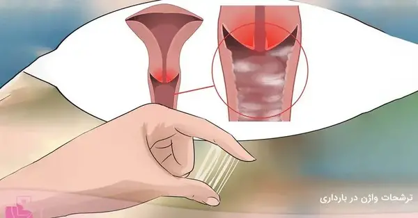 عکس ترشحات در بارداری