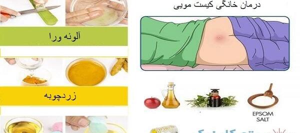عکس کیست مویی در مراحل اولیه