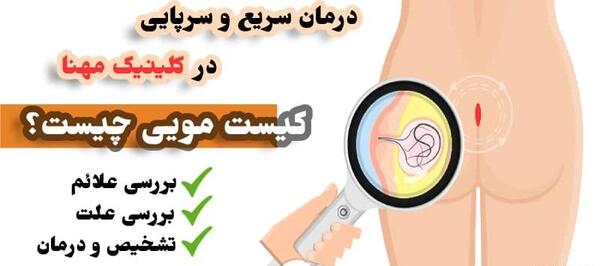 عکس کیست مویی در مراحل اولیه