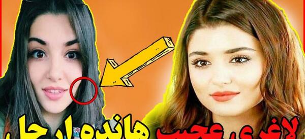 عکس های قبل و بعد لاغری هانده ارچل