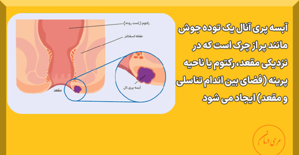 عکس عفونت مقعدی