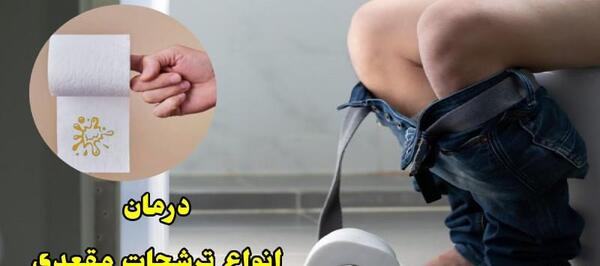 عکس عفونت مقعدی