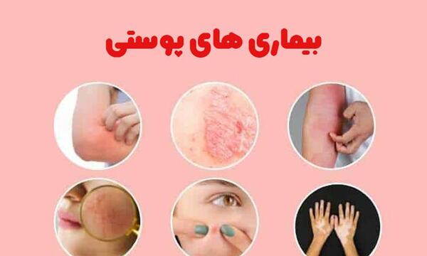 عکس بیماری های پوستی