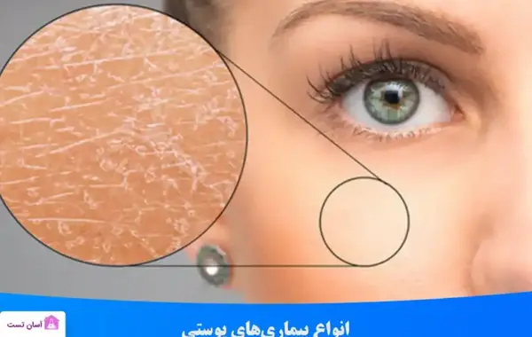 عکس بیماری های پوستی