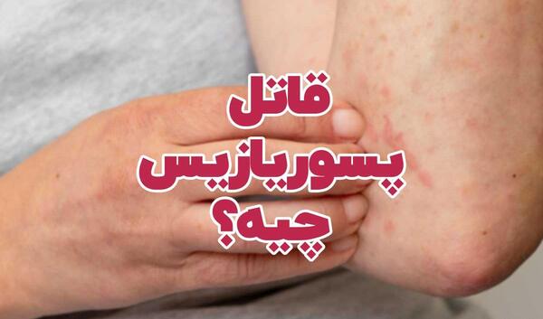 عکس پسوریازیس خفیف