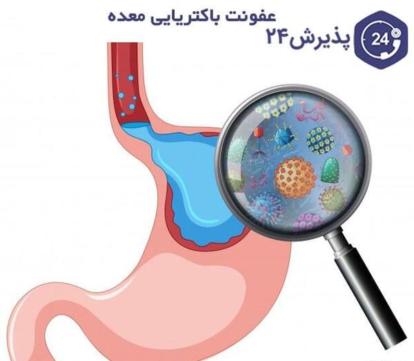 عکس عفونت در مدفوع