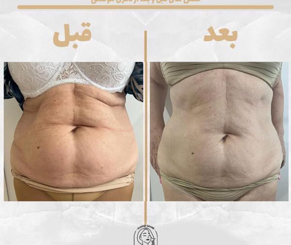 عکس های بعد از لاغری