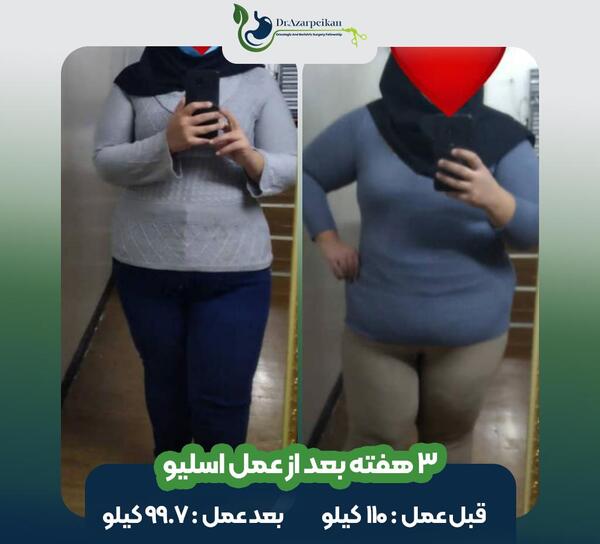 عکس های بعد از لاغری