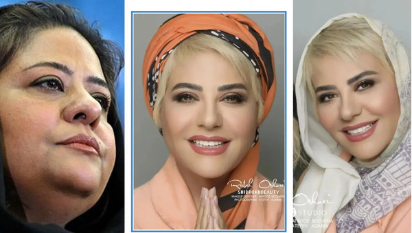 عکس های بعد از لاغری