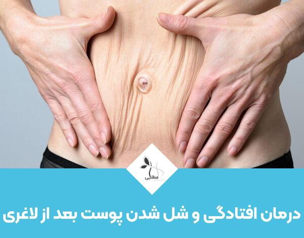 عکس های بعد از لاغری