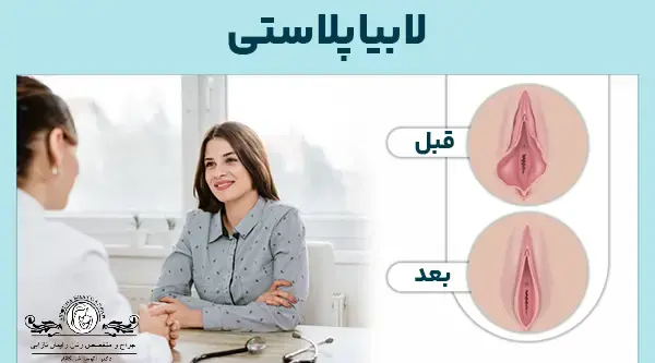عکس قبل و بعد از عمل لابیاپلاستی