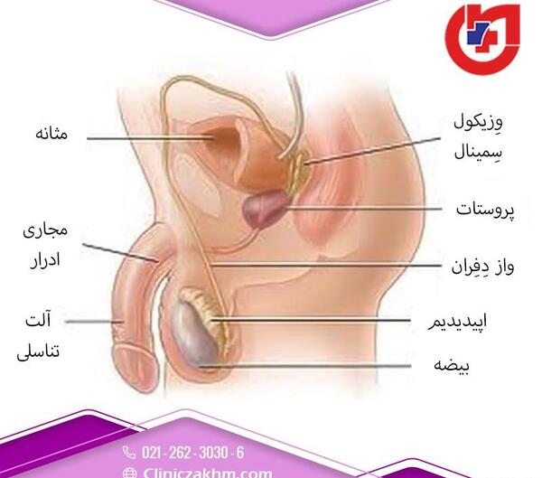 عکس آلت