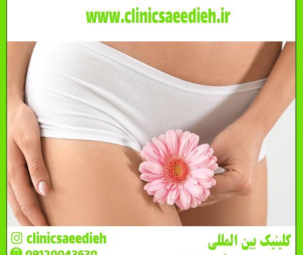 عکس آلت