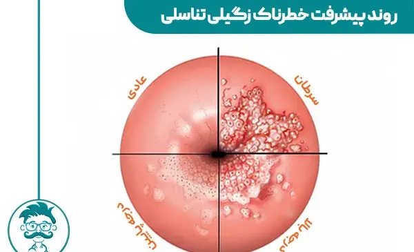 عکس آلت