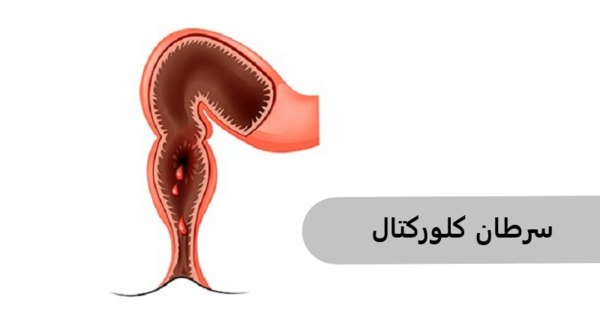 عکس خون در مدفوع