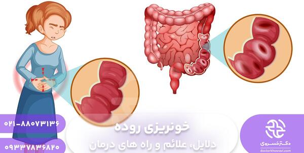 عکس خون در مدفوع