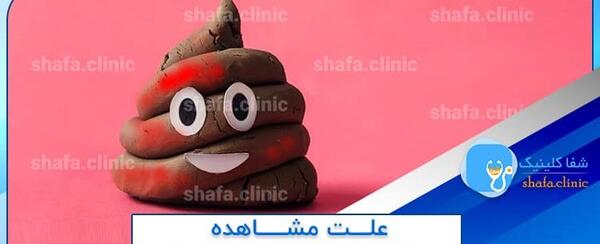 عکس خون در مدفوع