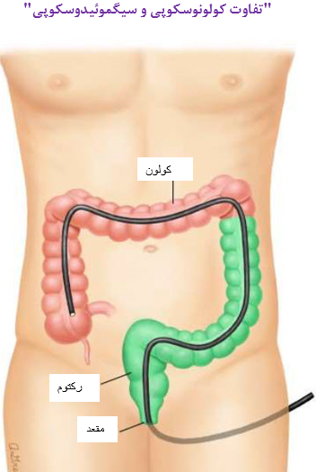 عکس خون در مدفوع