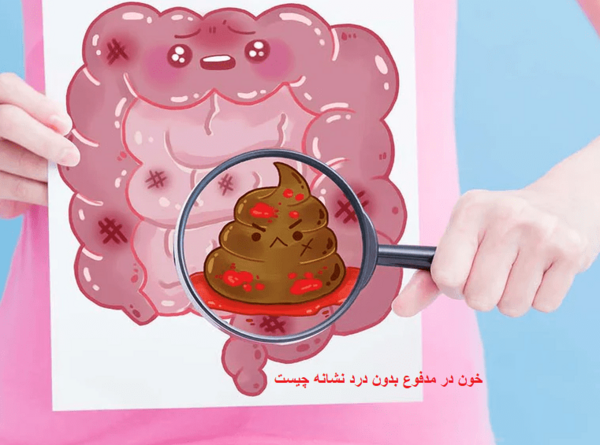 عکس خون در مدفوع