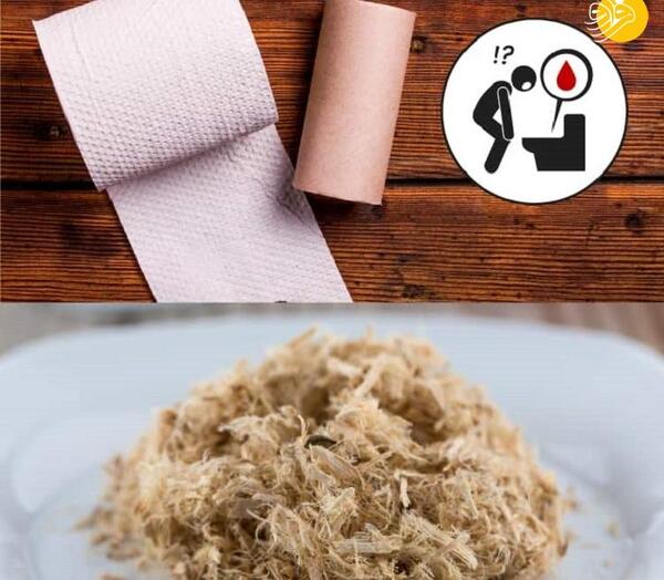 عکس خون در مدفوع
