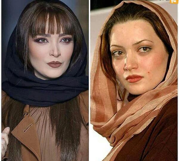 عکس الناز حبیبی قبل از عمل بینی