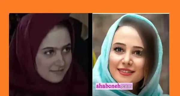 عکس الناز حبیبی قبل از عمل بینی