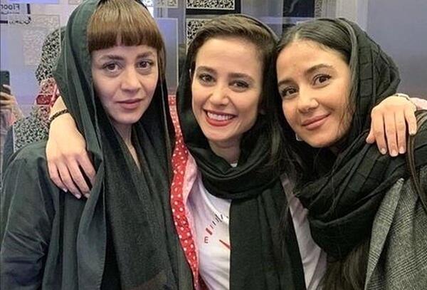 عکس الناز حبیبی قبل از عمل بینی