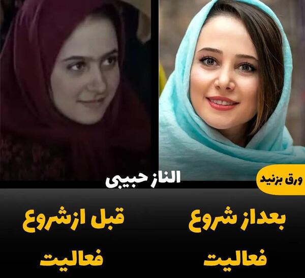عکس الناز حبیبی قبل از عمل بینی