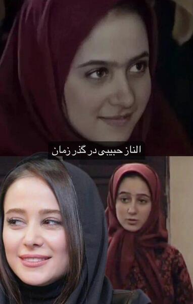 عکس الناز حبیبی قبل از عمل بینی