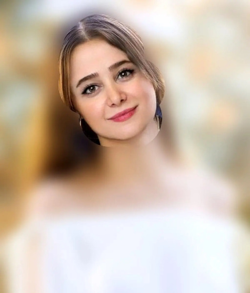 عکس الناز حبیبی قبل از عمل بینی