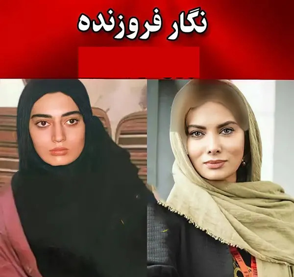 عکس الناز حبیبی قبل از عمل بینی