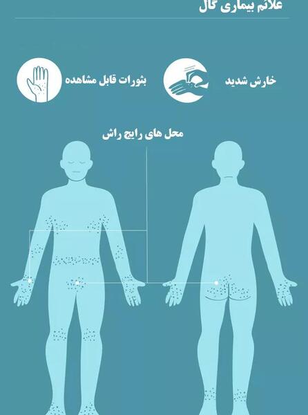 عکس بیماری پوستی گال
