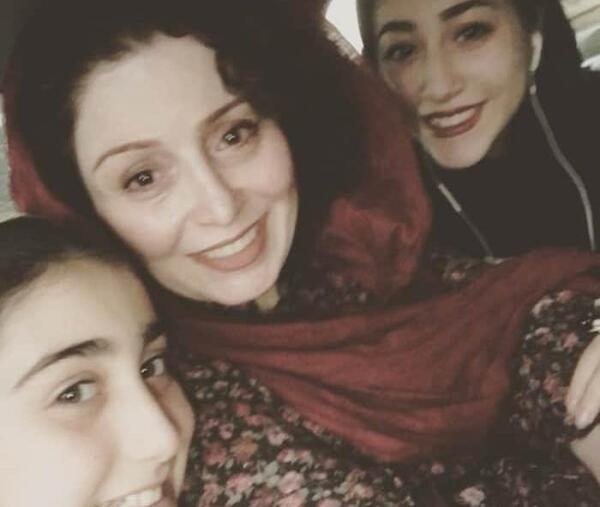 عکس ژاله صامتی قبل از عمل زیبایی